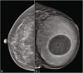 picture 1
